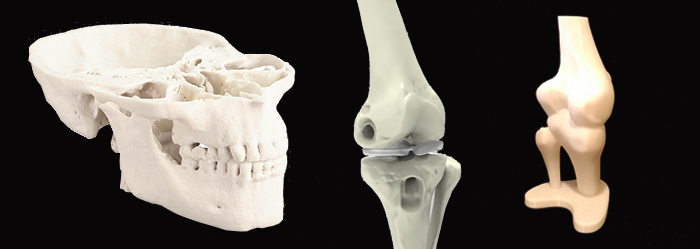 Impression 3D modle pour essai chirurgie mdicale